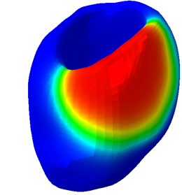 Left ventricle