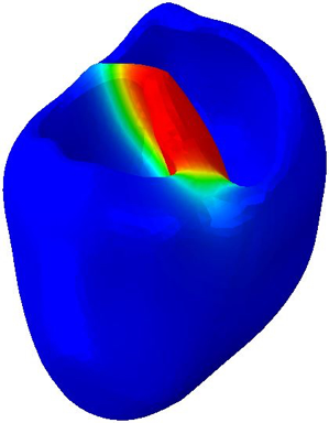 Biventricular model